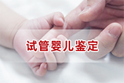 试管婴儿鉴定